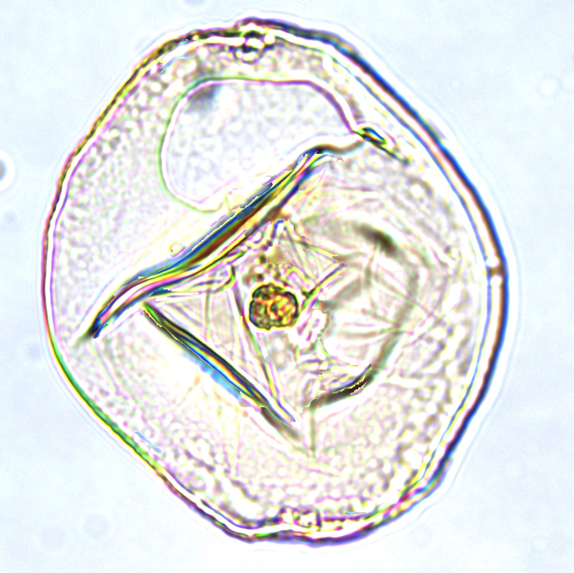 Manumiella seymourensis, U1581-19R-7W, 66-70, sl. 2, U19-24.jpg